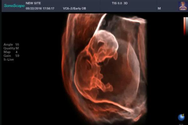 S Live-Silouette-Struttura-Anatomica