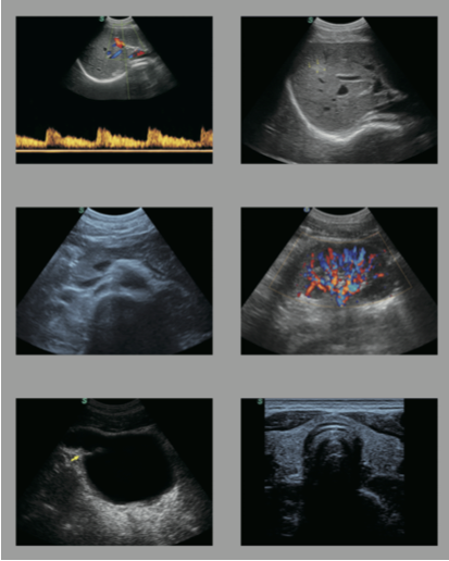 S11 demo image 1.png