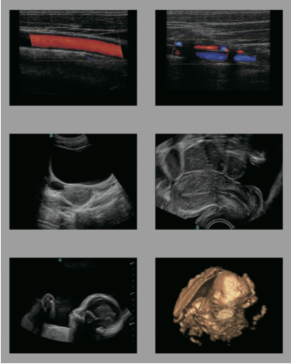 S11 demo image 2.png