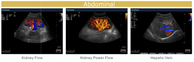 S20 demo image 1.png