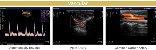 S20 demo image 2.png