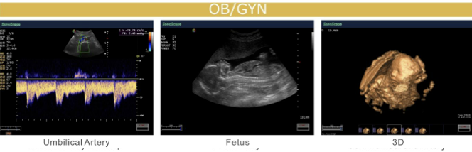 S20 demo image 3.png