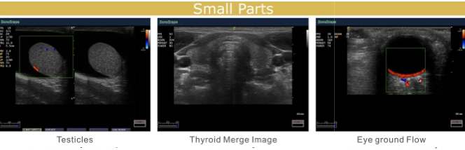 S20 demo image 5.png