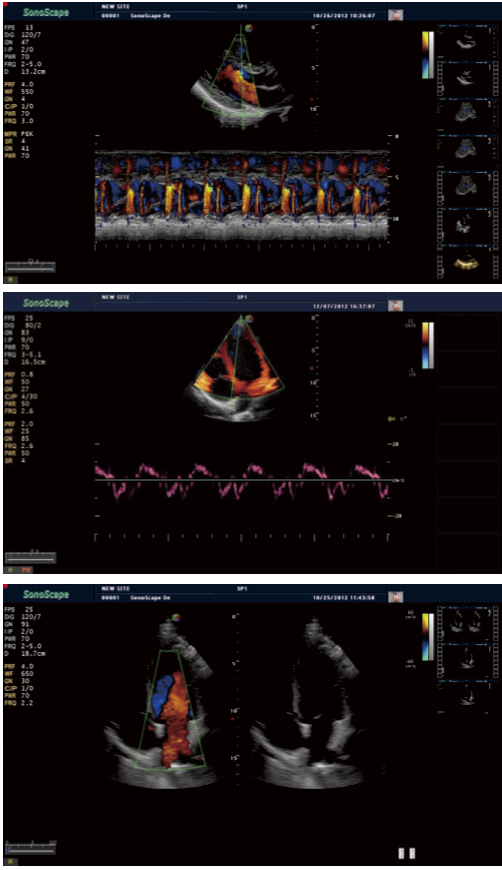 S40 demo image cardia.png