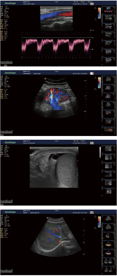 S40 demo image radio 1.png