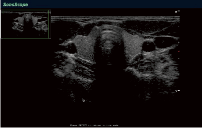 S40 demo image radio pano.png